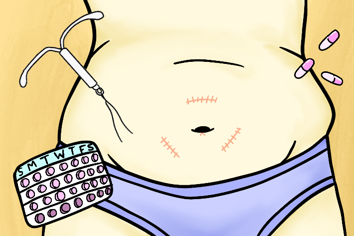 An illustration of a tummy with surgery marks, surrounded by pills, contraception
