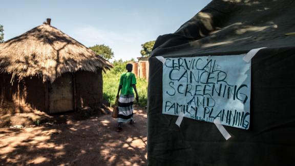Mobile cervical cancer clinic, Uganda. 